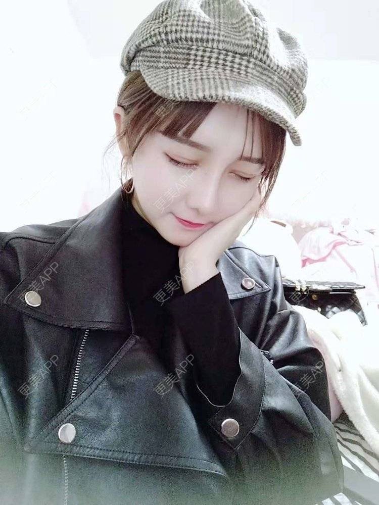 更美 - 小白白丫的埋线除皱经验 | 北京 | 视频日记 | 埋线除皱