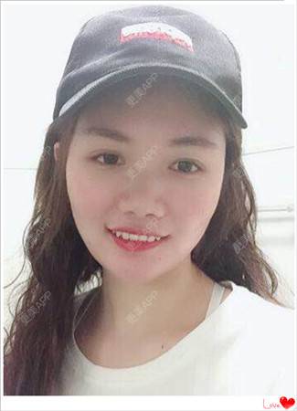 更美 - 简单de幸福！！的玻尿酸鼻部经验 | 玻尿酸鼻部 | 南昌