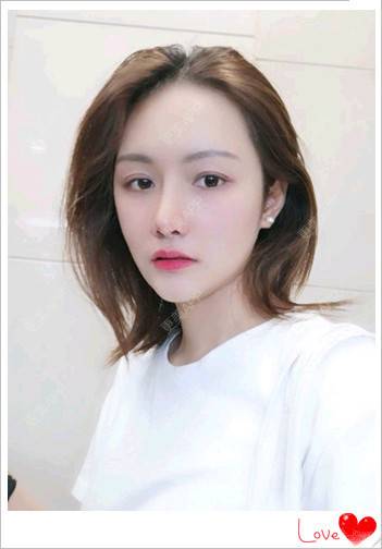 更美 - 简单de幸福！！的玻尿酸鼻部经验 | 玻尿酸鼻部 | 南昌