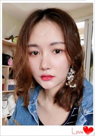 更美 - 简单de幸福！！的玻尿酸鼻部经验 | 玻尿酸鼻部 | 南昌