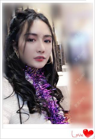 更美 - 简单de幸福！！的玻尿酸鼻部经验 | 玻尿酸鼻部 | 南昌