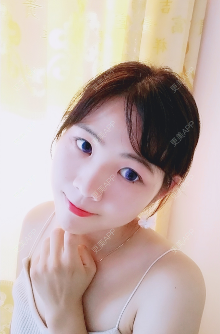 更美 - 更美用户3DPGdoNiI9的注射塑形肩部经验 | 注射塑形肩部 | 鞍山 | 视频日记
