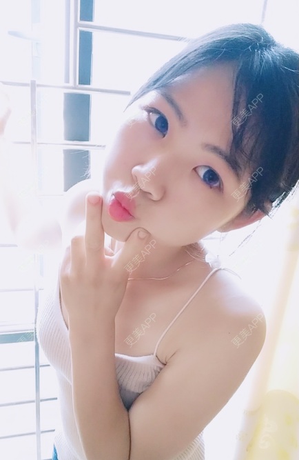 更美 - 更美用户3DPGdoNiI9的注射塑形肩部经验 | 注射塑形肩部 | 鞍山 | 视频日记