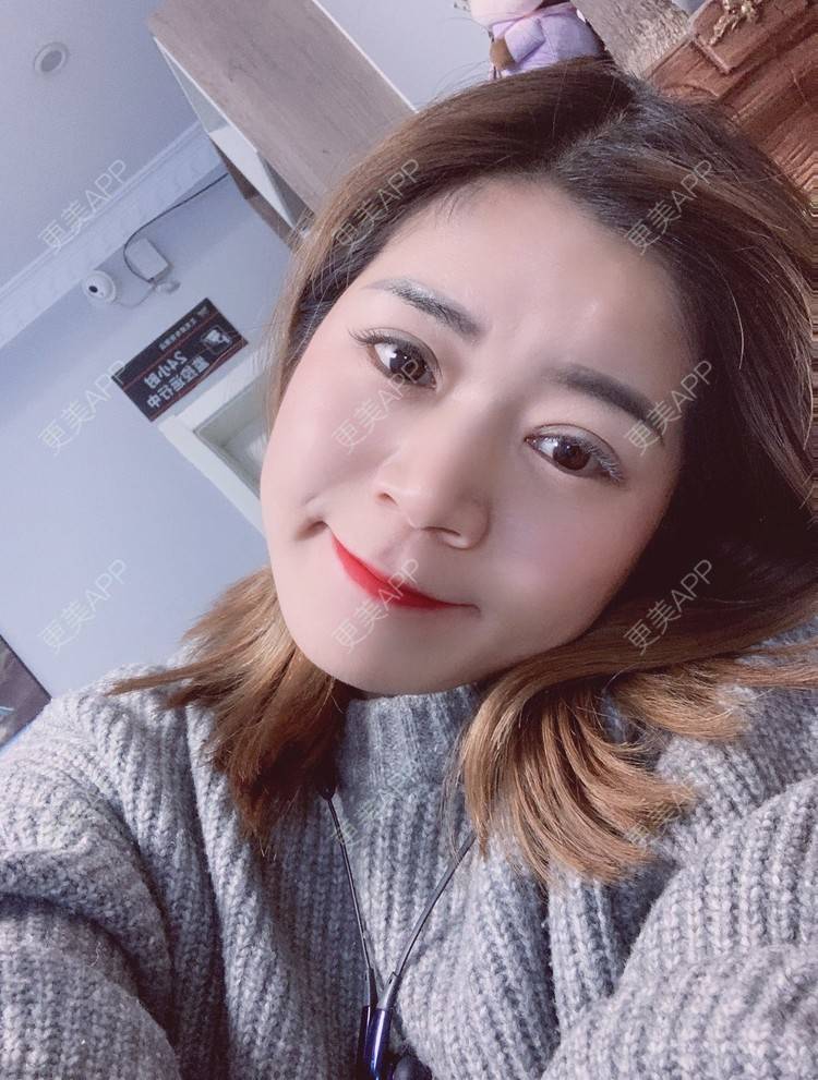 更美 - 更美用户B6Dwb08pzE的眼综合修复经验 | 眼综合修复 | 眼部综合
