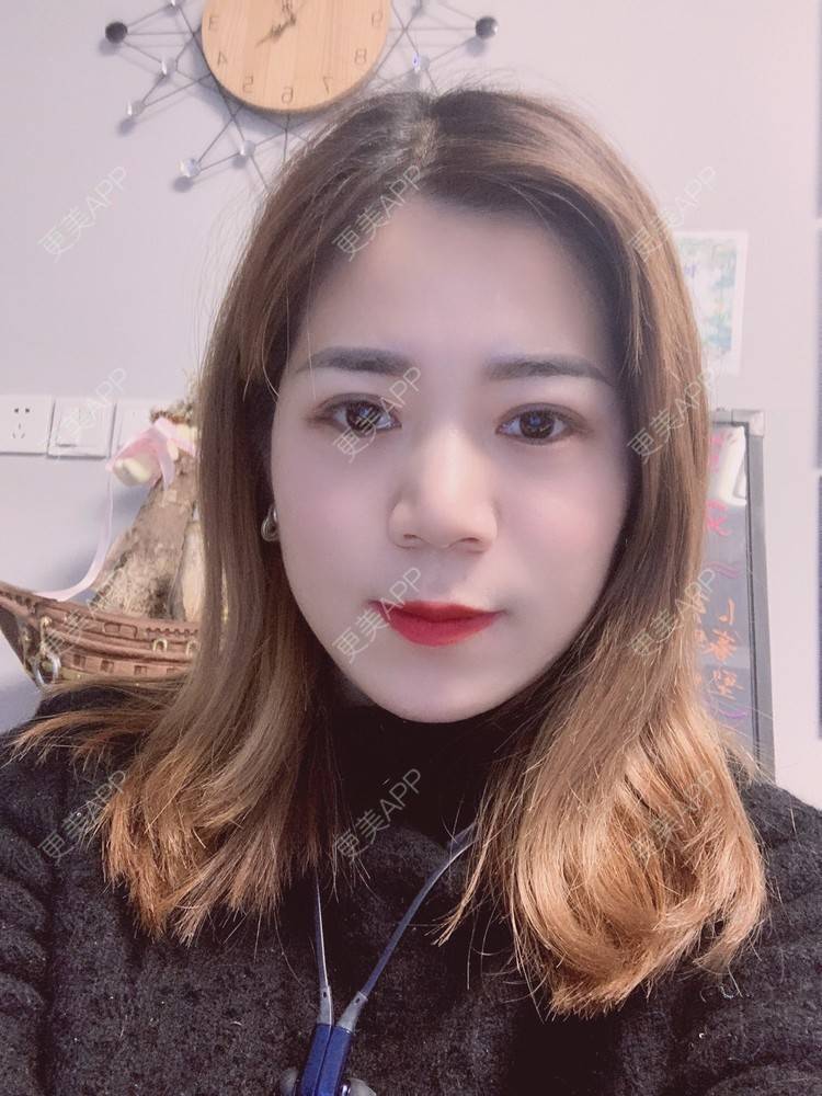 更美 - 更美用户B6Dwb08pzE的眼综合修复经验 | 眼综合修复 | 眼部综合