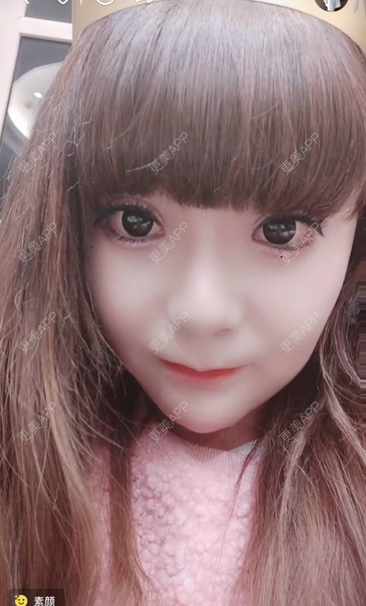 更美 - 更美用户lBnn40gnCa的热玛吉经验 | 视频日记 | 石家庄 | 热玛吉