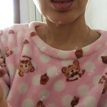 更美用户X6u7ZrZMyz