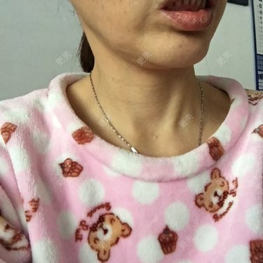 更美用户X6u7ZrZMyz