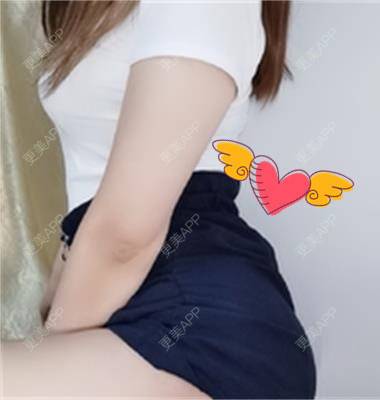 更美 - 更美用户RCdJ1h8KiA的自体脂肪丰臀经验 | 自体脂肪丰臀