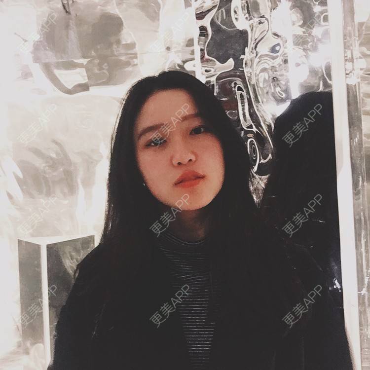 更美 - Baby熊熊的颧骨内推经验 | 颧骨颧弓整形 | 颧骨内推