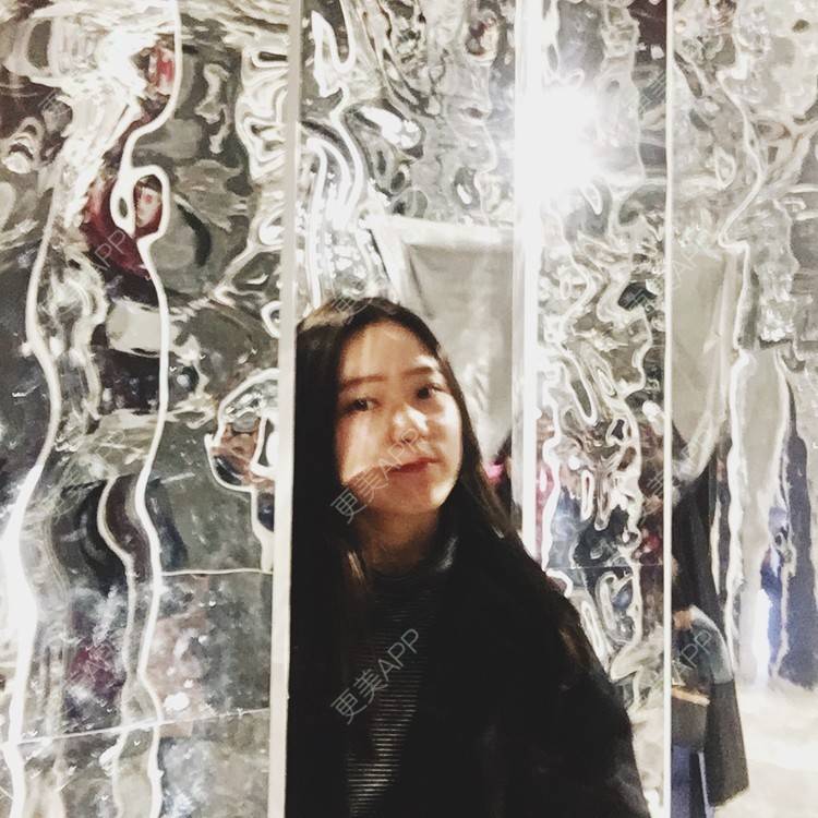 更美 - Baby熊熊的颧骨内推经验 | 颧骨颧弓整形 | 颧骨内推