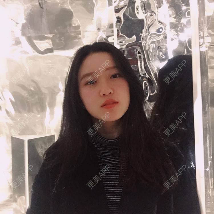 更美 - Baby熊熊的颧骨内推经验 | 颧骨颧弓整形 | 颧骨内推