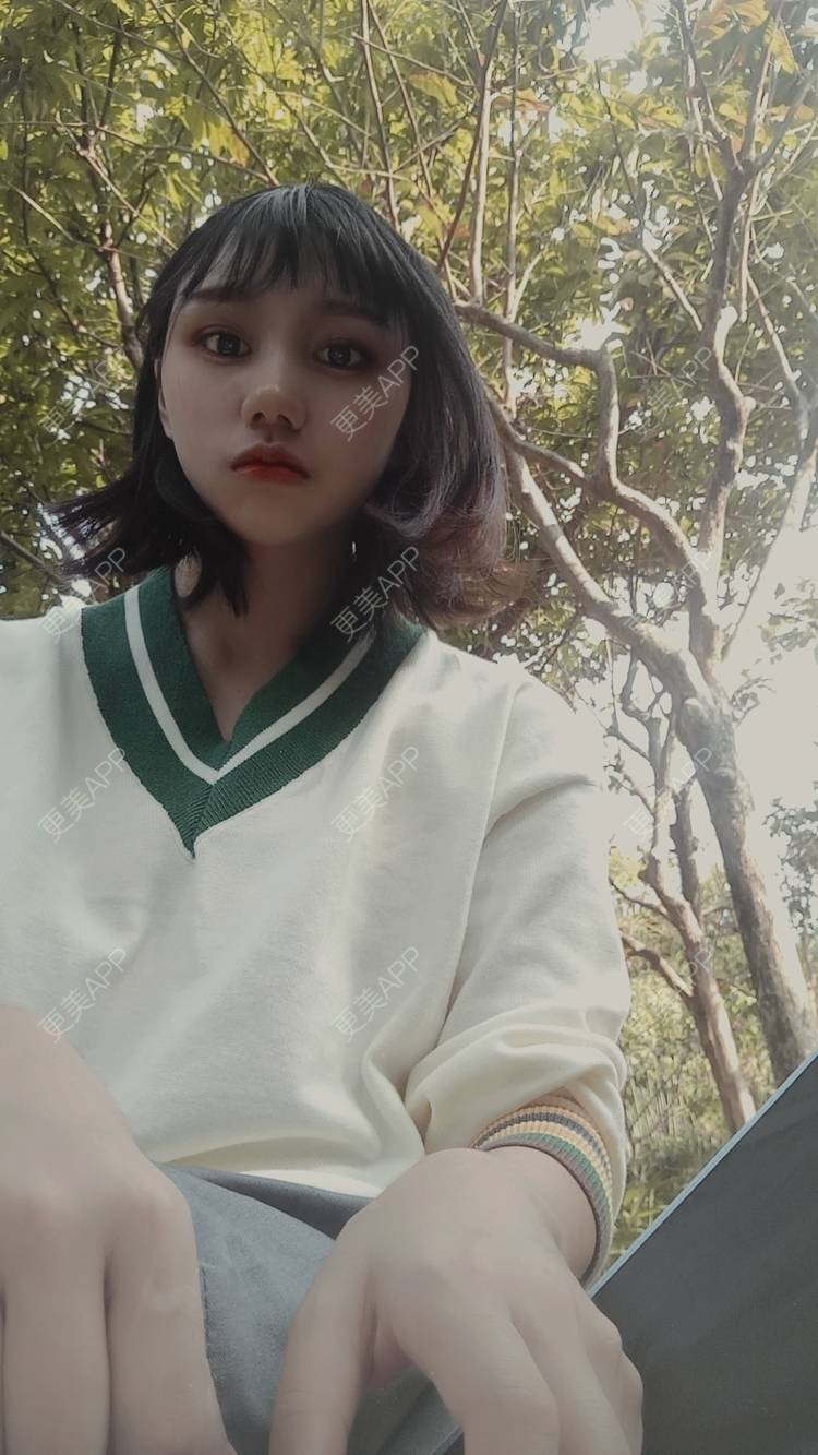 更美 - 紫夏之梦6的厚唇改薄经验 | 厚唇改薄 | M唇成形 | 微笑唇手术 | 唇综合 | 深圳