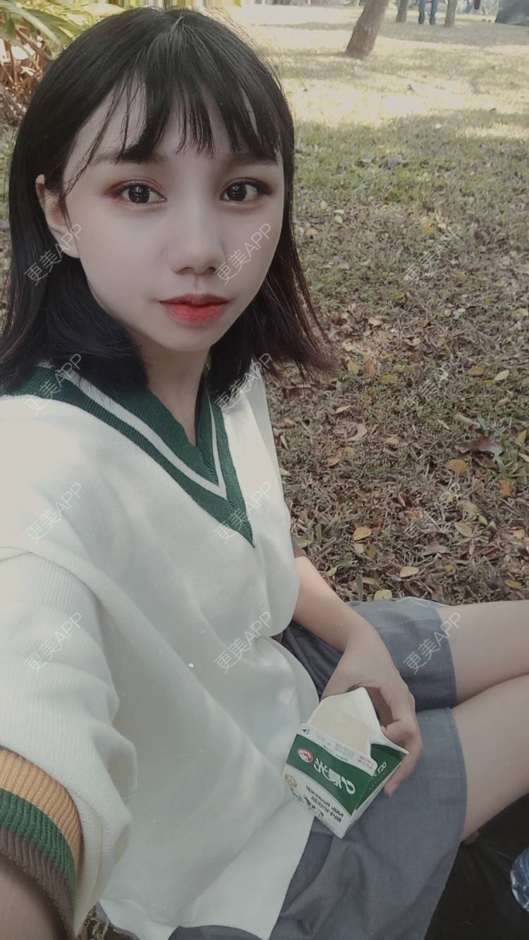 更美 - 紫夏之梦6的厚唇改薄经验 | 厚唇改薄 | M唇成形 | 微笑唇手术 | 唇综合 | 深圳
