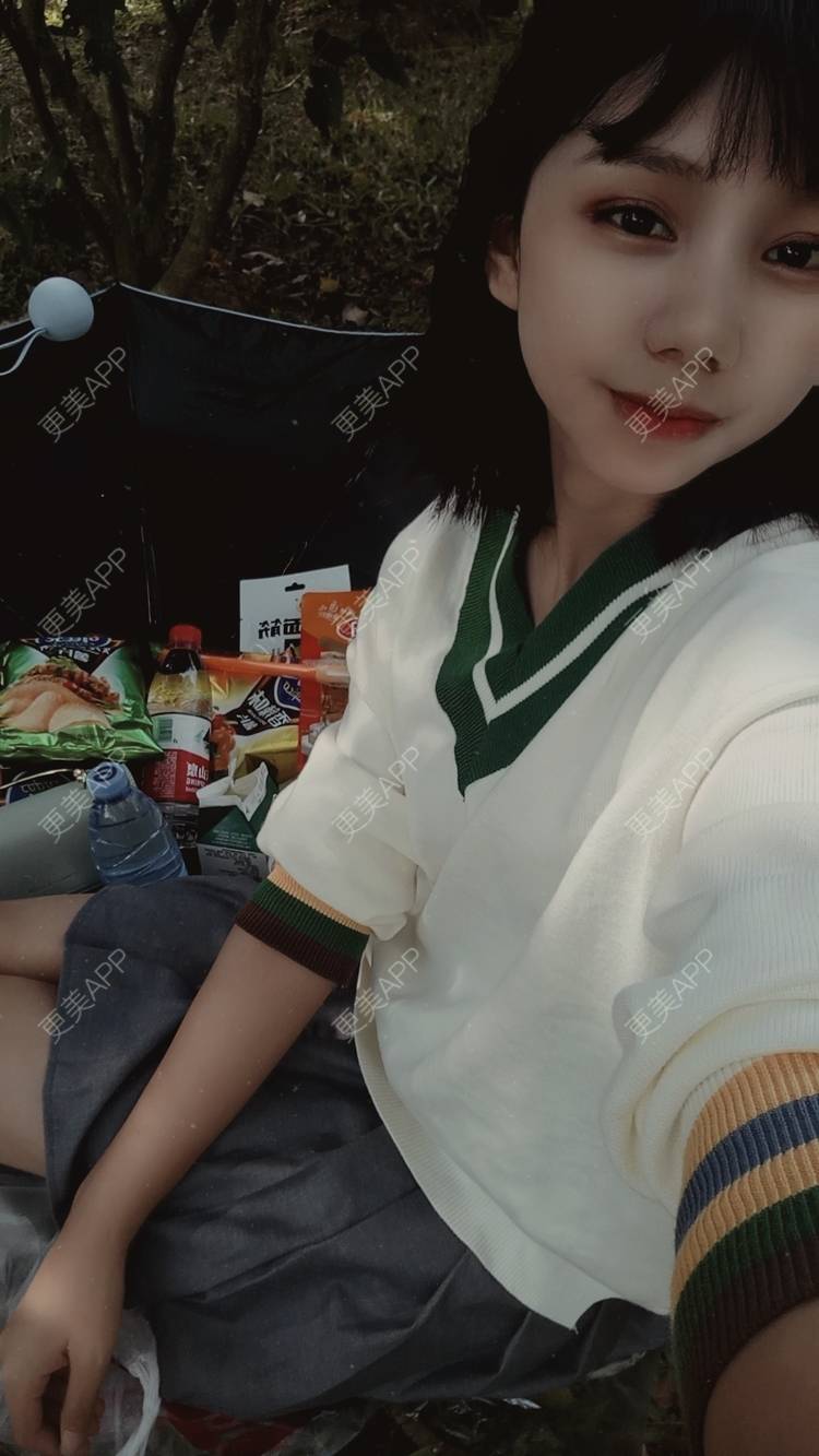 更美 - 紫夏之梦6的厚唇改薄经验 | 厚唇改薄 | M唇成形 | 微笑唇手术 | 唇综合 | 深圳
