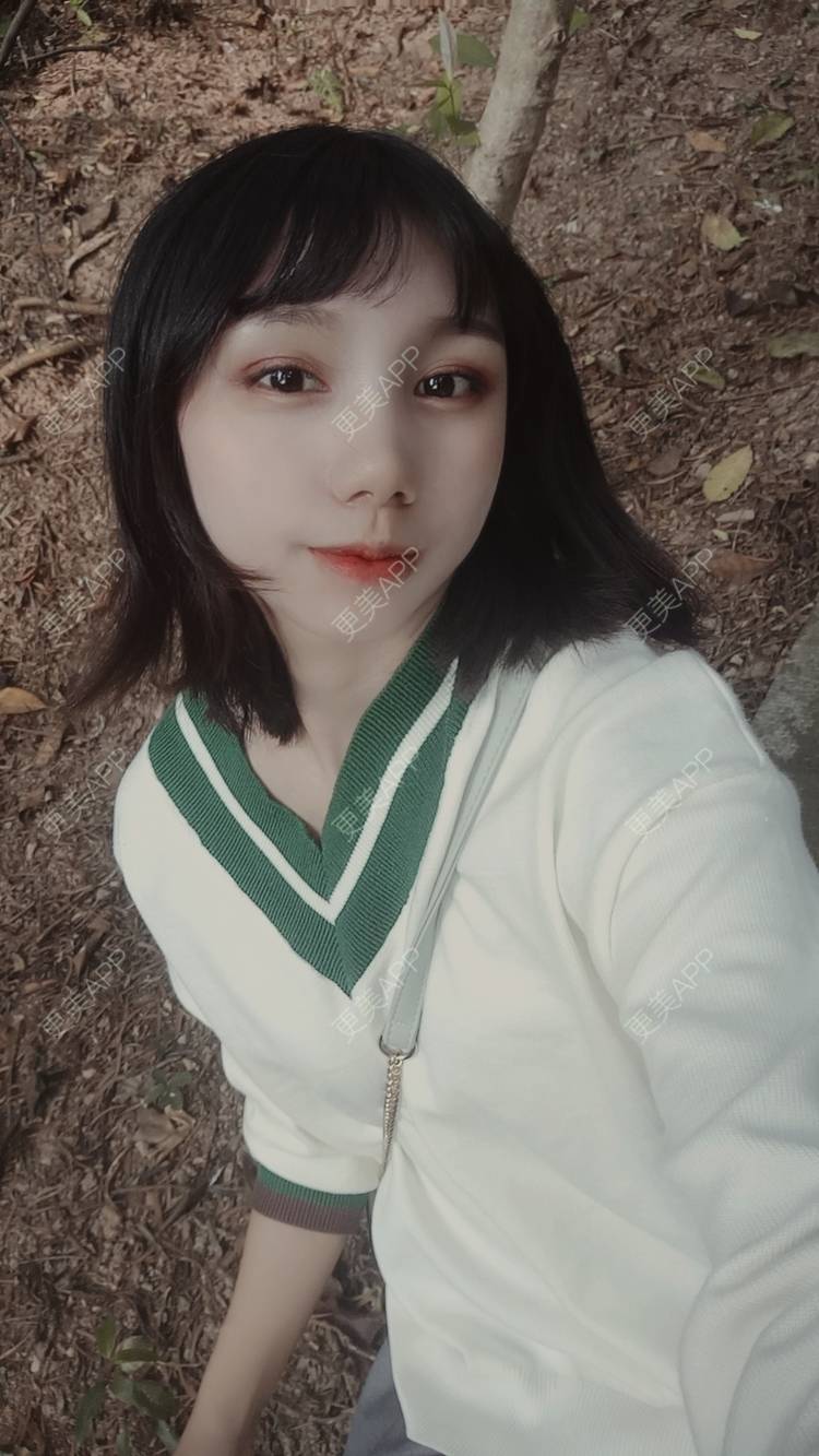 更美 - 紫夏之梦6的厚唇改薄经验 | 厚唇改薄 | M唇成形 | 微笑唇手术 | 唇综合 | 深圳