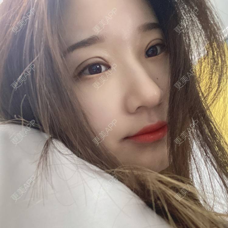 更美 - 更美用户M8F1b1X61v的眼部多项经验 | 眼部多项 | 南京