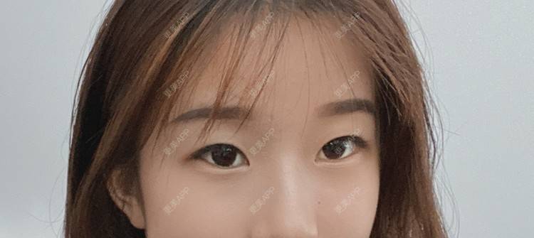 更美 - 更美用户M8F1b1X61v的眼部多项经验 | 眼部多项 | 南京