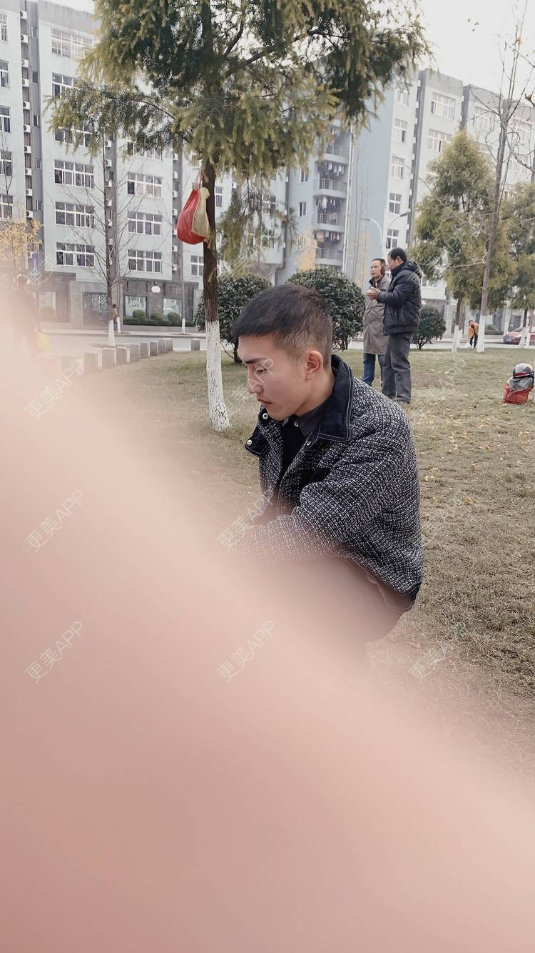 更美 - D调··的植发际线经验 | 植发际线 | 成都