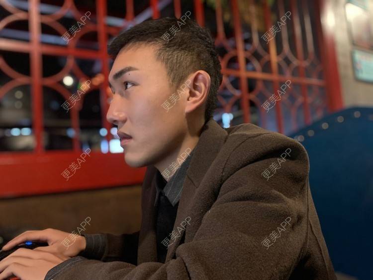 更美 - D调··的植发际线经验 | 植发际线 | 成都