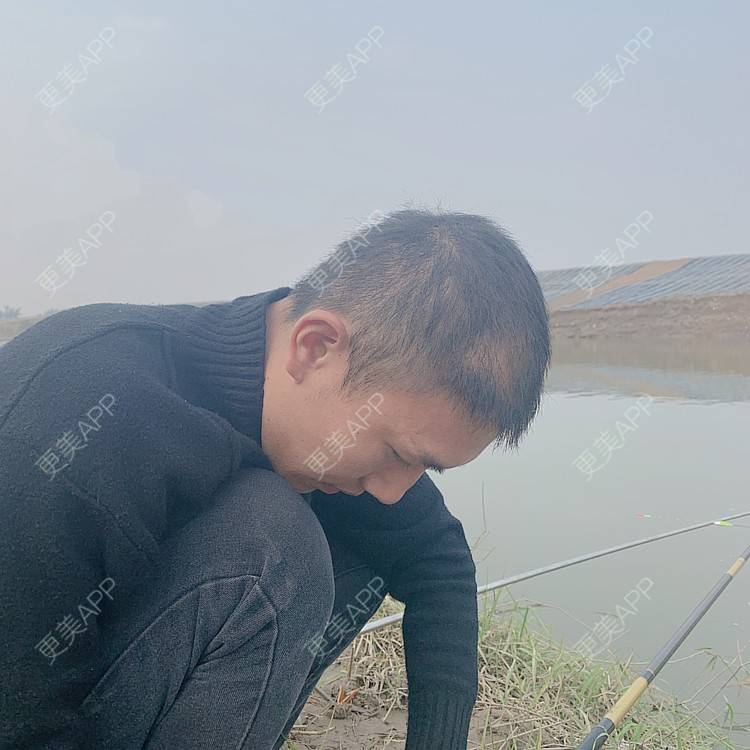 更美 - D调··的植发际线经验 | 植发际线 | 成都