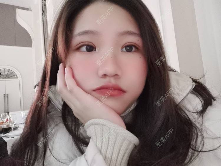 更美 - 更美用户vEYSVRoyDa的眼部多项经验 | 眼部多项 | 南京