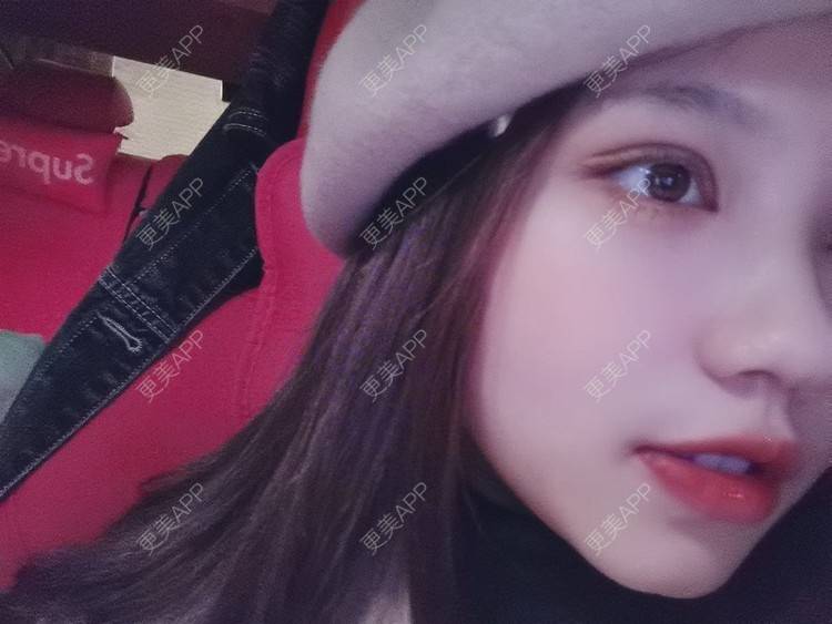 更美 - 更美用户vEYSVRoyDa的眼部多项经验 | 眼部多项 | 南京