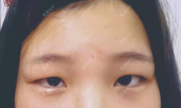 更美 - 更美用户vEYSVRoyDa的眼部多项经验 | 眼部多项 | 南京