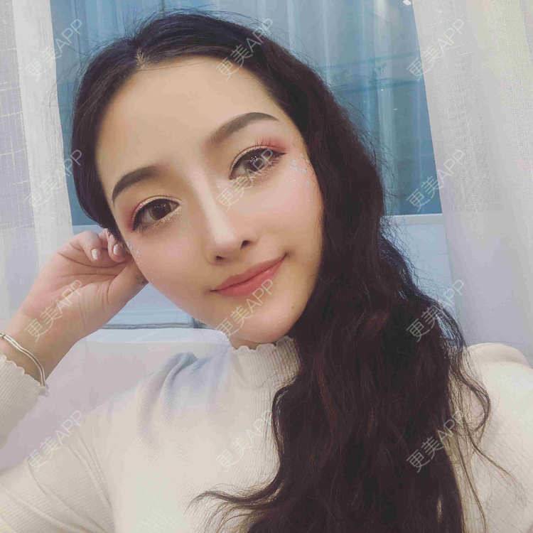 更美 - 佳人人家的鼻部多项经验 | 视频日记 | 鼻部多项 | 重庆