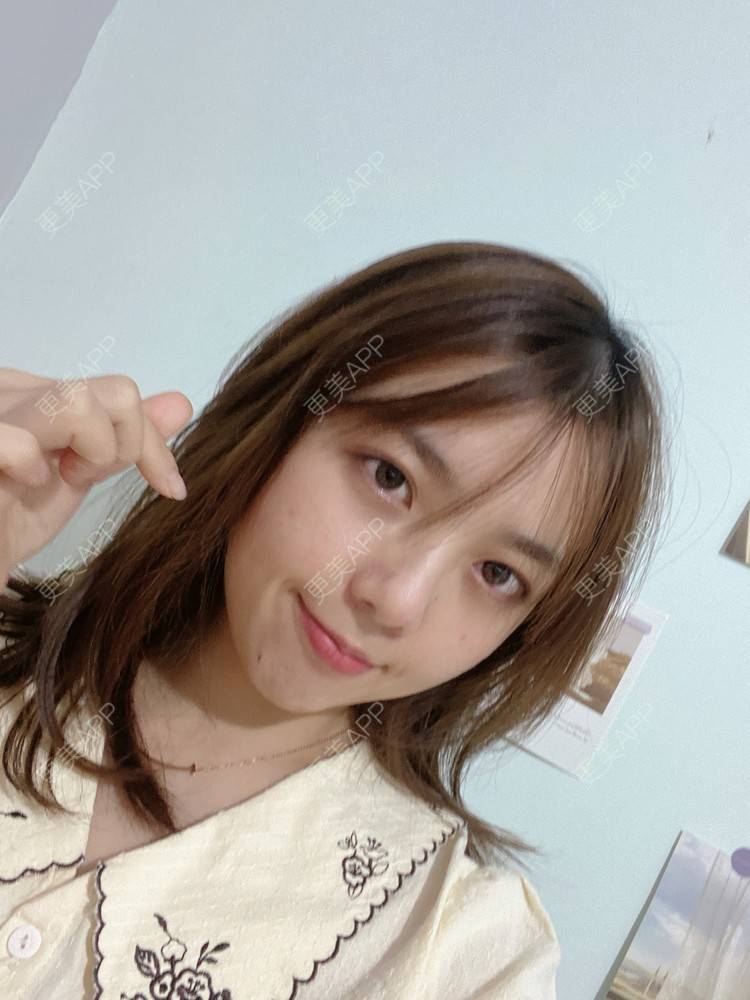 更美 - 周萱萱周周的小切口手术提升经验 | 北京 | 小切口手术提升