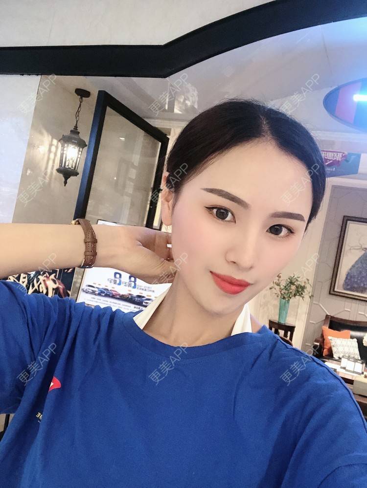 更美 - 更美用户TOjE4YH38k的隆鼻经验 | 北京 | 视频日记 | 隆鼻