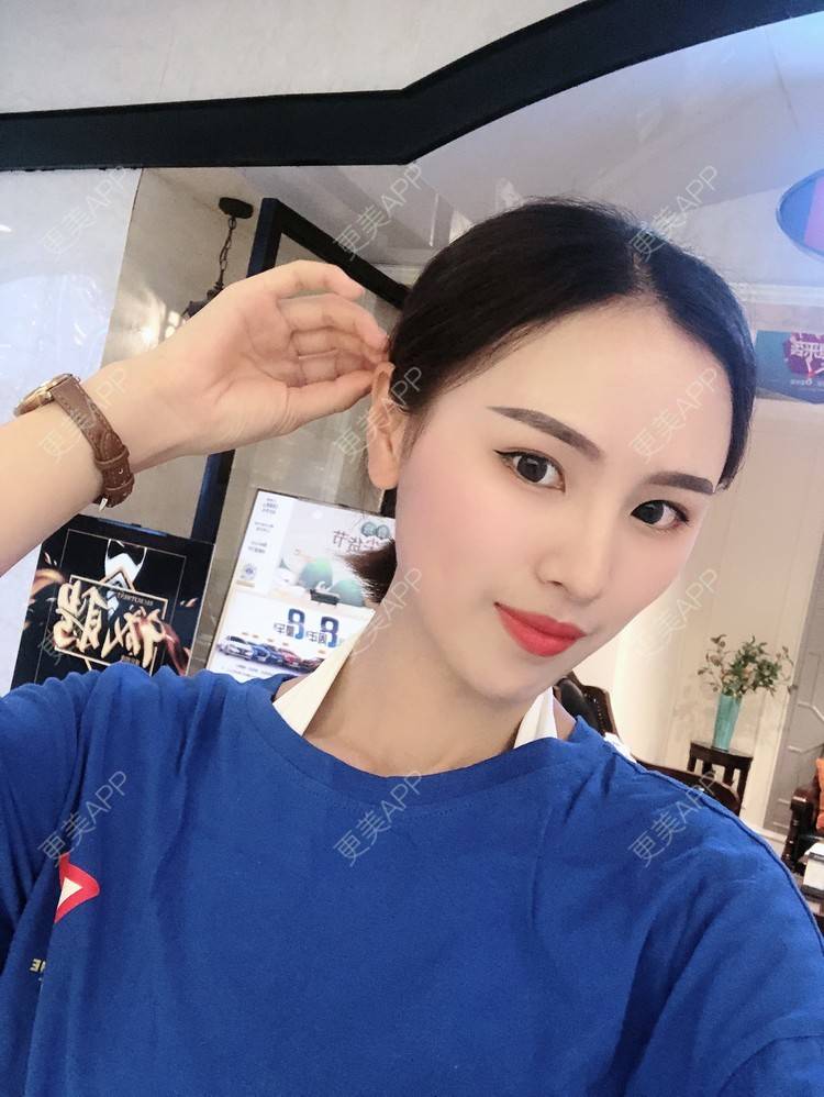 更美 - 更美用户TOjE4YH38k的隆鼻经验 | 北京 | 视频日记 | 隆鼻