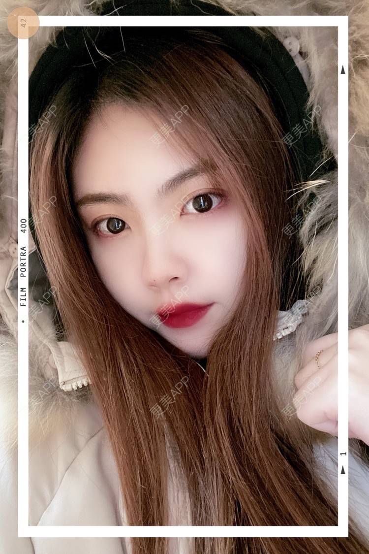 更美 - 旺旺掀被。的双眼皮经验 | 双眼皮 | 全切双眼皮 | 开内眼角 | 长沙 | 上眼睑去脂 | 眼部多项