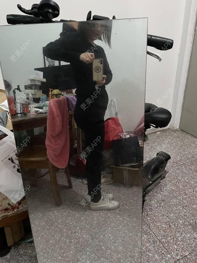 更美 - 誐吥渼、狚婧堔己的吸脂经验 | 吸脂 | 吸脂瘦大腿 | 北京 | 视频日记