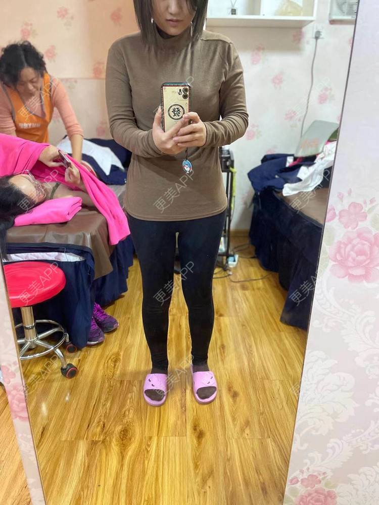 更美 - 誐吥渼、狚婧堔己的吸脂经验 | 吸脂 | 吸脂瘦大腿 | 北京 | 视频日记