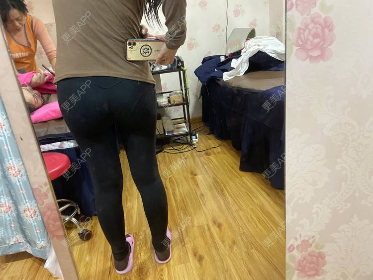 更美 - 誐吥渼、狚婧堔己的吸脂经验 | 吸脂 | 吸脂瘦大腿 | 北京 | 视频日记