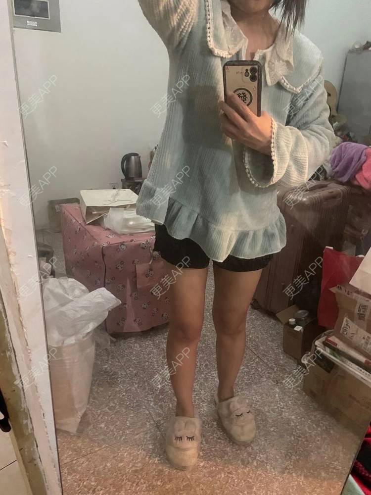 更美 - 誐吥渼、狚婧堔己的吸脂经验 | 吸脂 | 吸脂瘦大腿 | 北京 | 视频日记