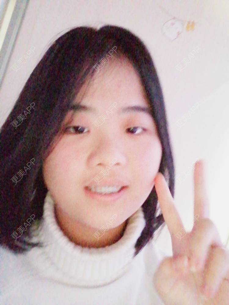 更美 - 鱼不咸咸的金属托槽矫正经验 | 金属托槽矫正 | 成都