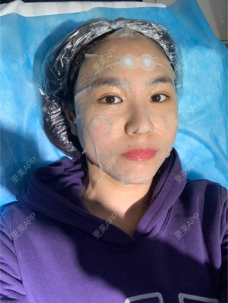 更美 - Shirley灬杨的白瓷娃娃经验 | 北京 | 白瓷娃娃