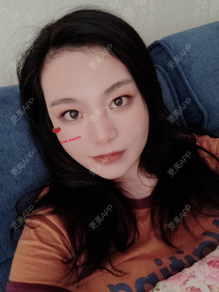 更美 - 脸小脸小的全脸整形套餐经验 | 成都 | 全脸整形套餐 | 视频日记