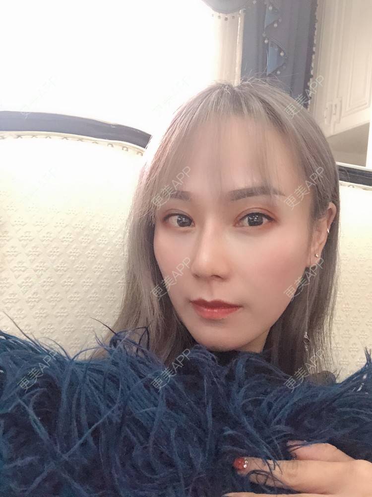 更美 - 更美用户EMNpjPf7Gn的下颌角经验 | 上海 | 全脸整形套餐 | 下颌角 | 颧骨内推