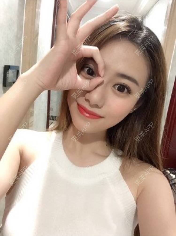 更美 - 更美用户vyjk75N8Vb的自体脂肪隆胸经验 | 自体脂肪隆胸 | 上海