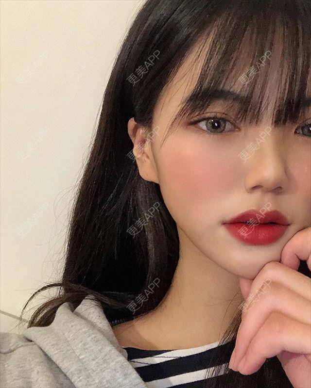 更美 - 更美用户MWTft9IbeG的综合去眼袋经验 | 综合去眼袋