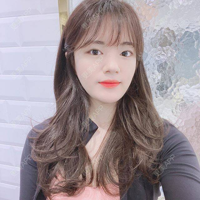 更美 - 更美用户7mVQ1aXBY0的综合去眼袋经验 | 综合去眼袋