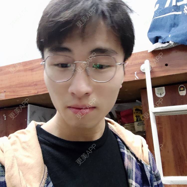 更美 - 香香aa的牙齿矫正经验 | 牙齿矫正