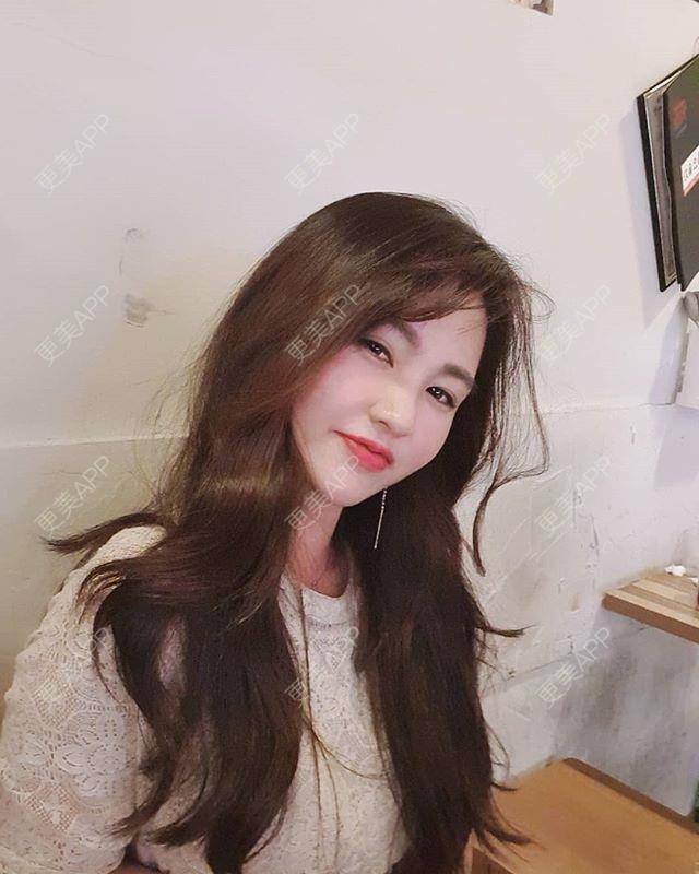 更美 - 更美用户iiwC6296FA的手术缩鼻头经验 | 手术缩鼻头