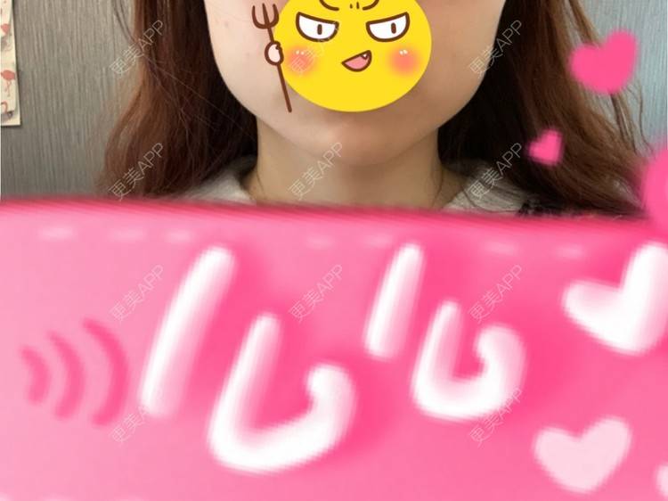 更美 - 更美用户l5RE8rSRcc的除皱瘦脸经验 | 除皱瘦脸 | 北京 | 更美研究所