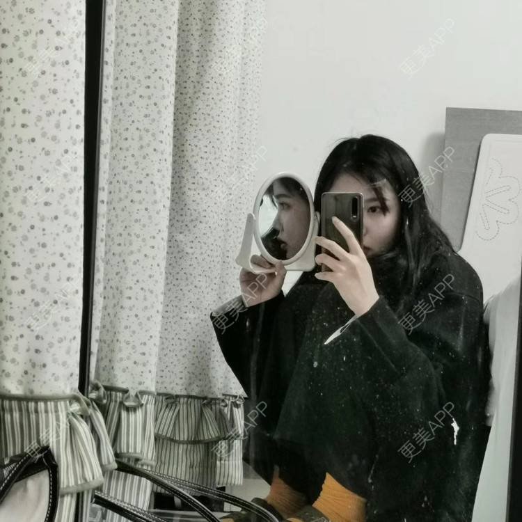 更美 - 菠萝蜜双双的吸脂瘦脸经验 | 吸脂瘦脸 | 长沙 | 瘦脸