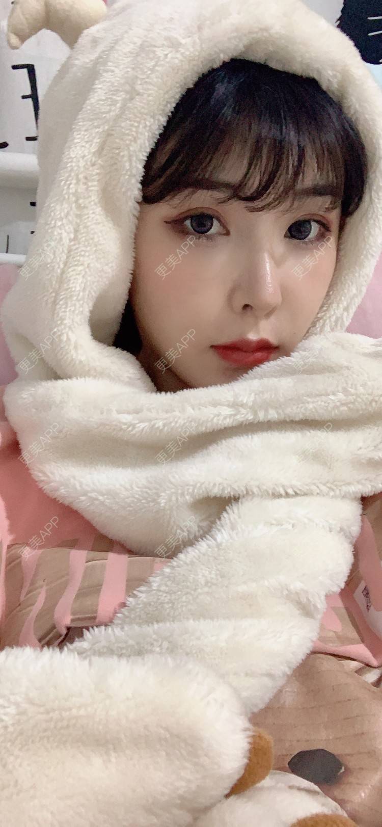 更美 - 更美用户tQrsyaKGg8的肋软骨隆鼻经验 | 北京 | 肋软骨隆鼻