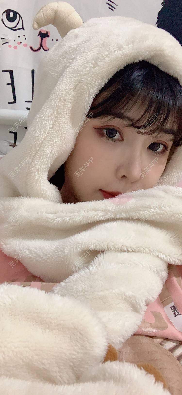 更美 - 更美用户tQrsyaKGg8的肋软骨隆鼻经验 | 北京 | 肋软骨隆鼻